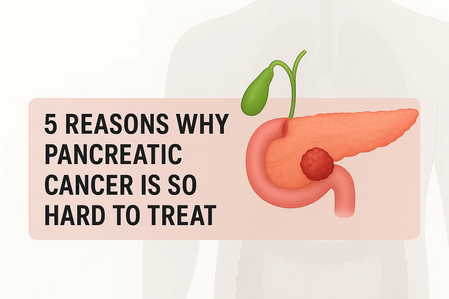 pancreatic cancer