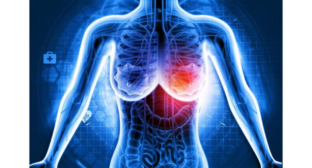 Identify Breast Cancer