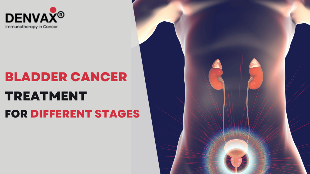 Bladder Cancer Treatment For Different Stages