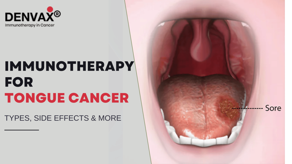 Immunotherapy for Tongue Cancer