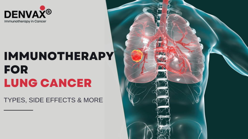 immunotherapy for lung cancer