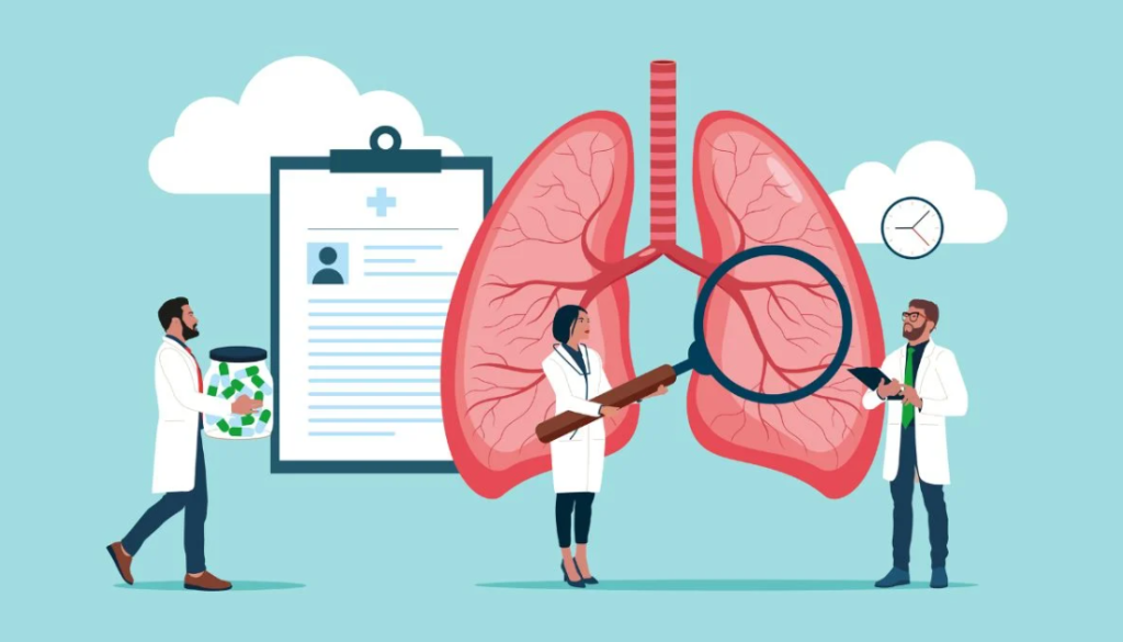 Lung Cancer Treatment