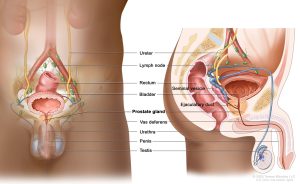 Prostate Cancer Treatment