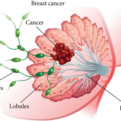 Illustration of milk making lobules and shuttling ducts glandular epithelial cells Q640