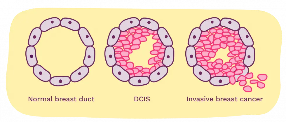 dcis illustration rgb 01 0