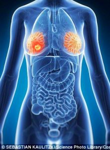 31C6C65700000578 0 Stanford scientists found women with lower vitamin D levels had a 31 1456940490954