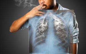 Blog54 SMOKING AND LUNG CANCER