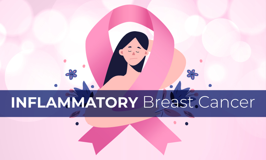 Inflammatory Breast