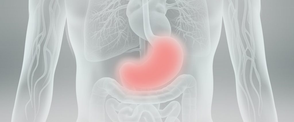 Stomach Cancer Symptoms