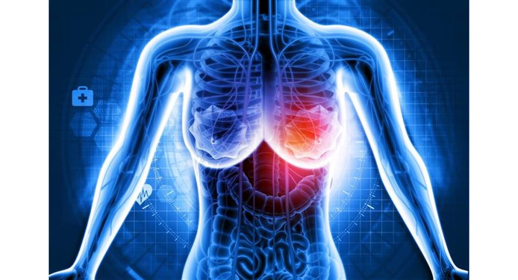 Identify Breast Cancer