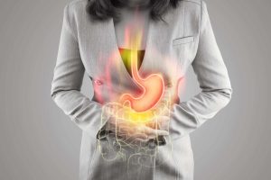 Stomach Ulcers