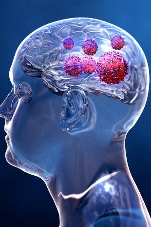 Brain Cancer Immunotherapy Treatment