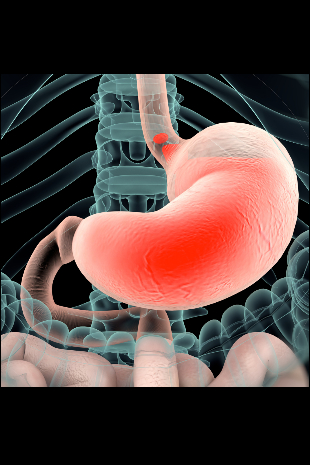 Stomach Cancer Immunotherapy Treatment