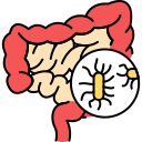ANAL CANCER