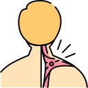 ANAL CANCER